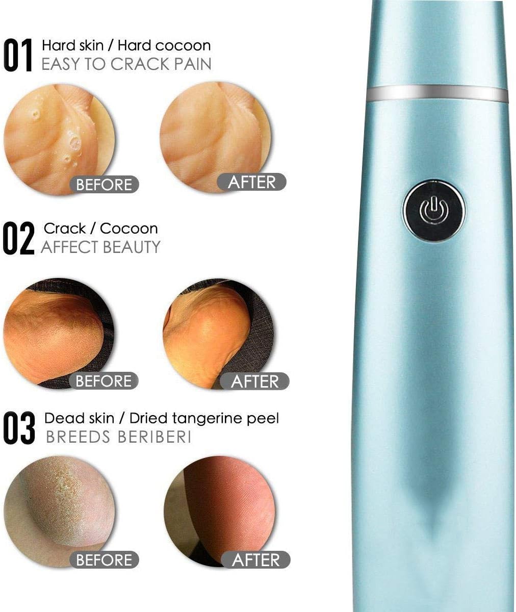 SilkaFeet™ | Effortlessly smooth and well-groomed feet