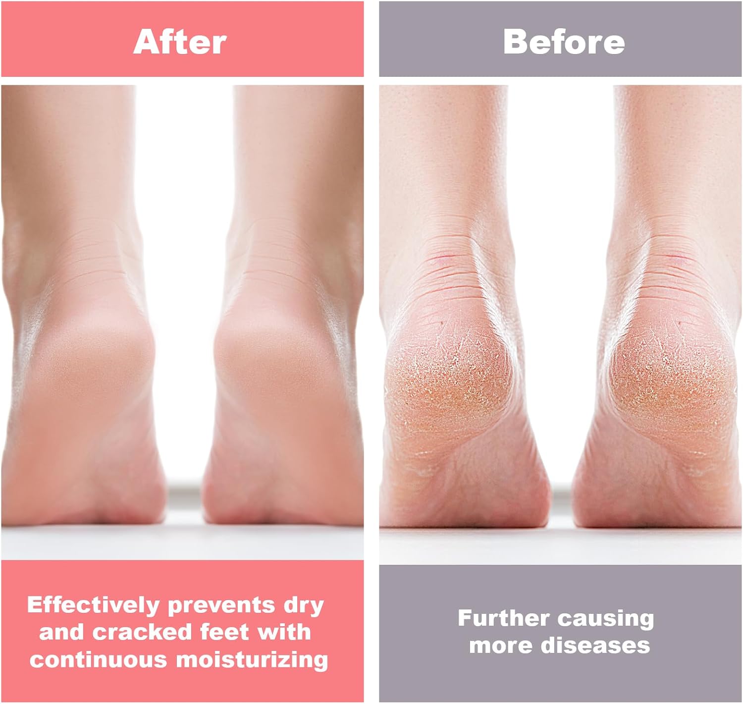1+1 Free | HeelHaven™  | Say goodbye to dry, cracked heels and tired, aching feet!